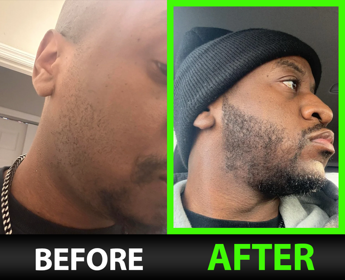 Aaron before and after